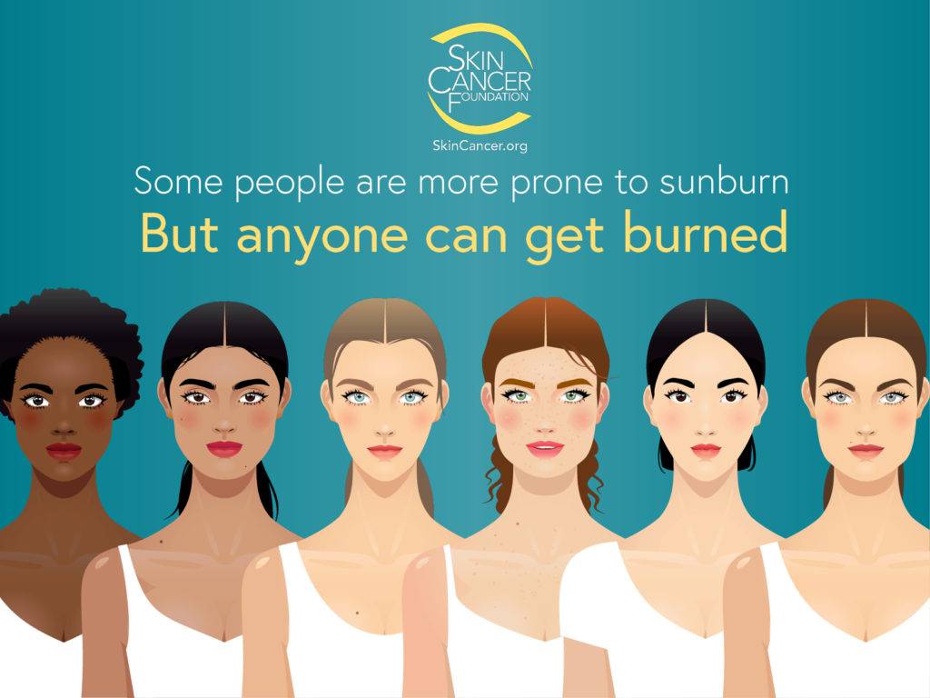 Image of people with different skin tones with the phrase "Some people are more prone to sunburn but anyone can get burned"